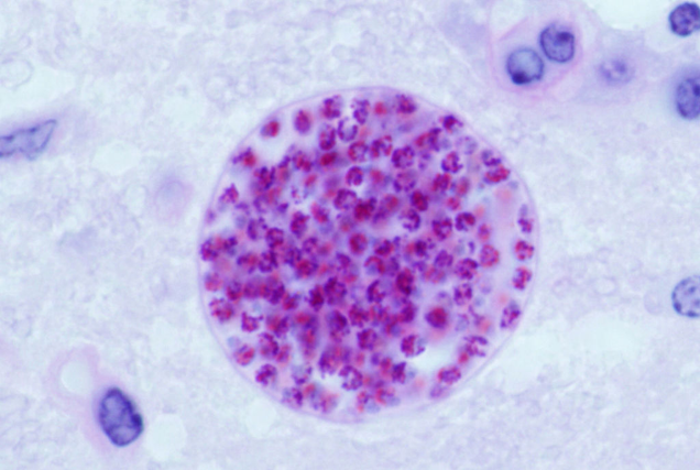 Toxoplasma gondii tissue cyst in a mouse brain. A correlation between the parasite and Intermittent Explosive Disorder (IED) in humans has been observed. IED causes people to react with inappropriate aggression.